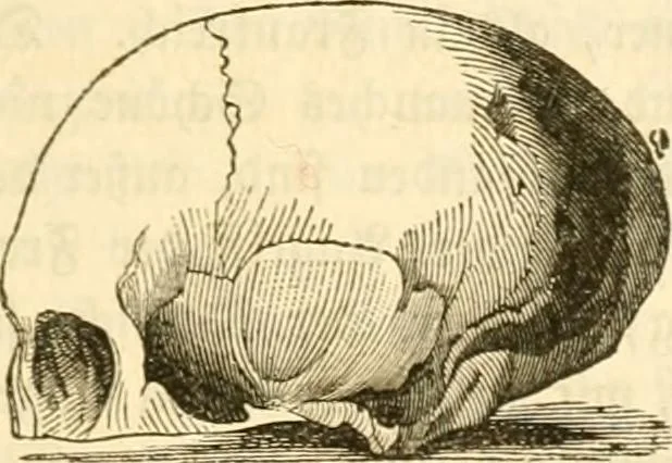 An illustration from Handbuch der Phrenologie, 1845, leaf 107