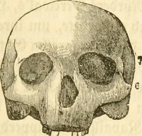 An illustration from Handbuch der Phrenologie, 1845, leaf 121