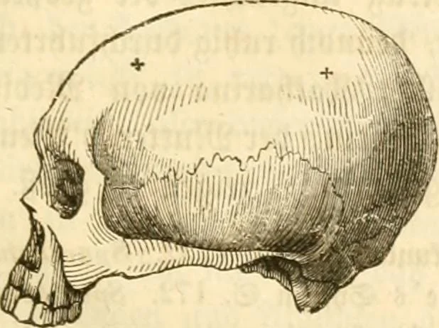 An illustration from Handbuch der Phrenologie, 1845, leaf 129