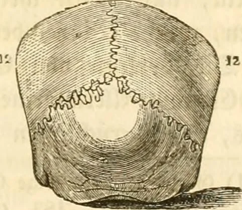 An illustration from Handbuch der Phrenologie, 1845, leaf 129