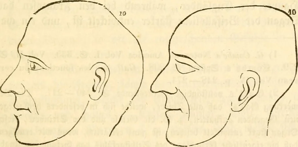 An illustration from Handbuch der Phrenologie, 1845, leaf 141