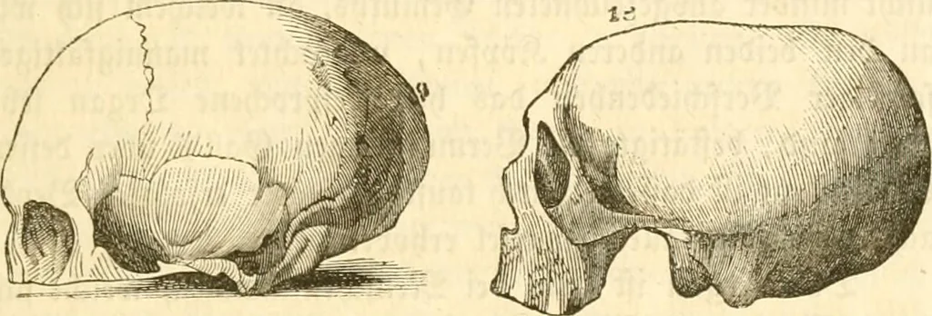 An illustration from Handbuch der Phrenologie, 1845, leaf 155