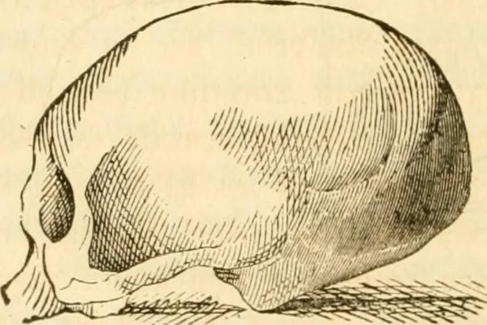 An illustration from Handbuch der Phrenologie, 1845, leaf 156