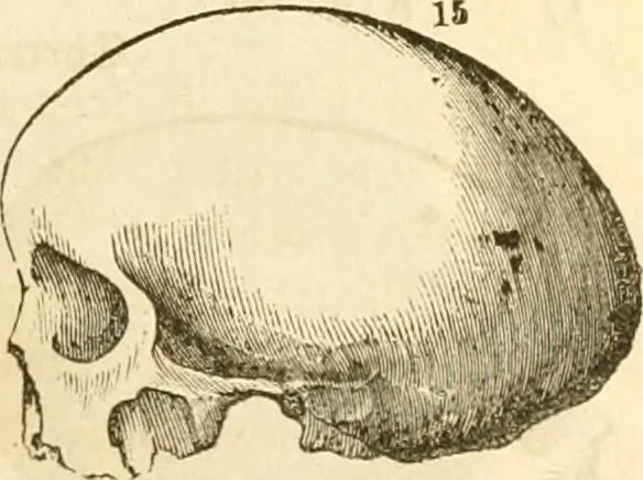 An illustration from Handbuch der Phrenologie, 1845, leaf 159
