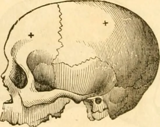 An illustration from Handbuch der Phrenologie, 1845, leaf 160