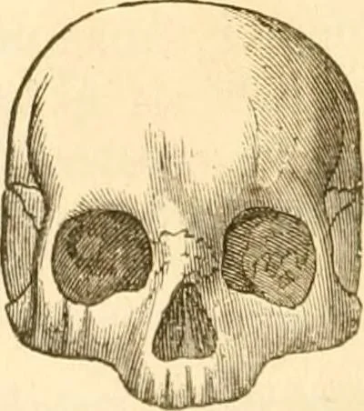 An illustration from Handbuch der Phrenologie, 1845, leaf 180