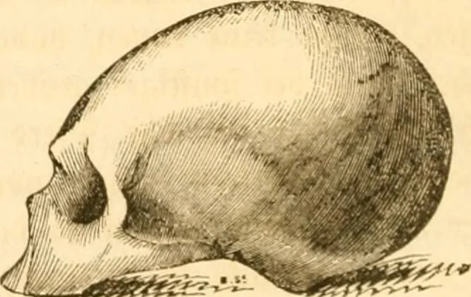 An illustration from Handbuch der Phrenologie, 1845, leaf 188