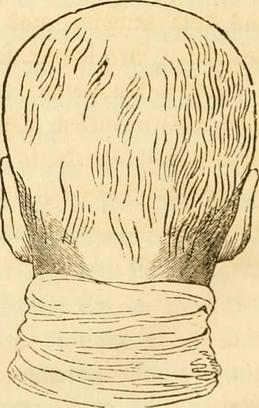 An illustration from Handbuch der Phrenologie, 1845, leaf 86