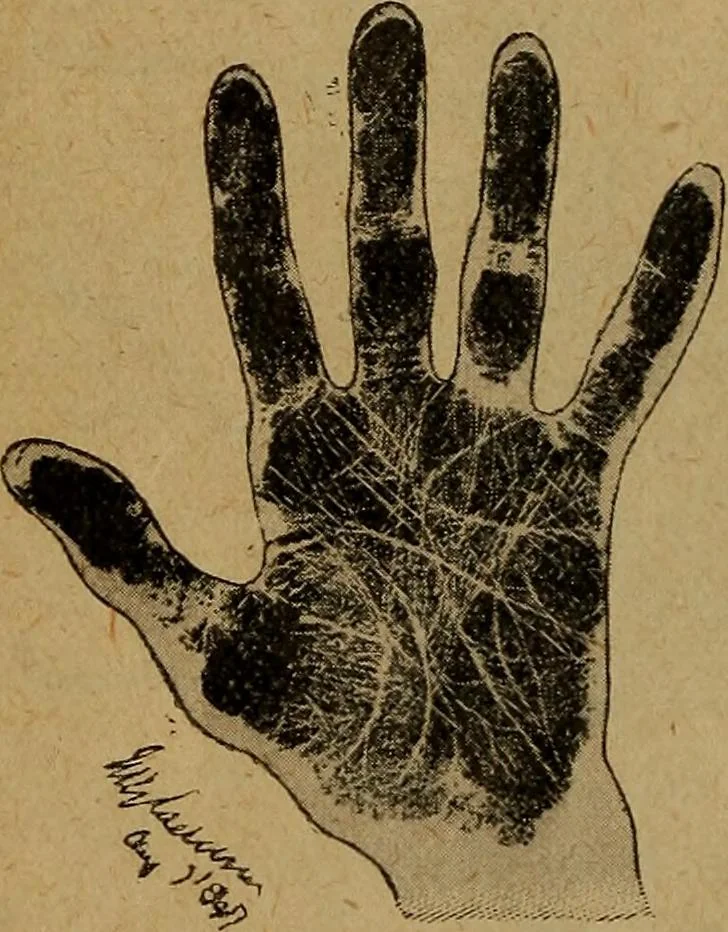 An illustration from The hand and its lines; a short treatise on palmistry .., 1902, leaf 20