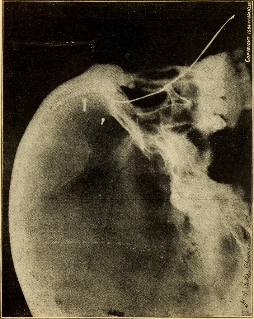 An illustration from Henry and Hora's modern electricity; a practical working encyclopedia, 1915, leaf 15