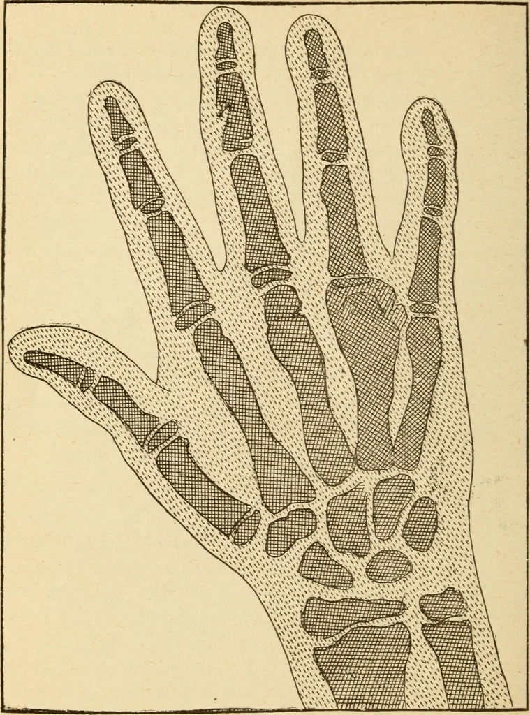 An illustration from Henry and Hora's modern electricity; a practical working encyclopedia, 1915, leaf 307