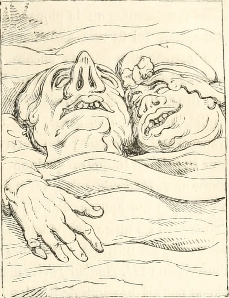 An illustration from Histoire de la caricature et du grotesque dans la littérature et dans l'art, 1875, leaf 482