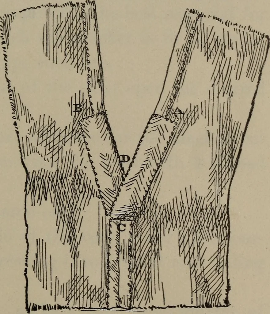 An illustration from Home and school sewing, 1901, leaf 64