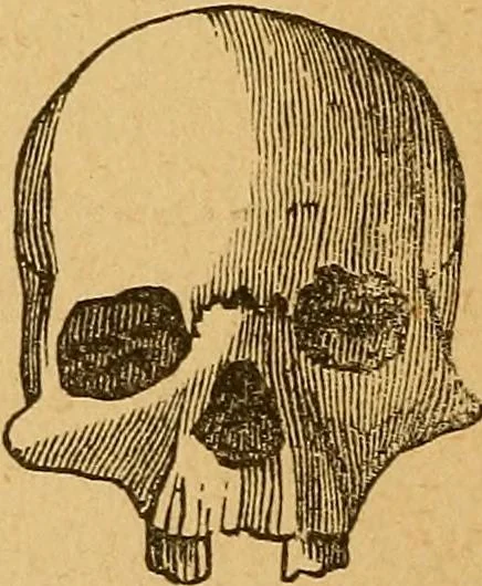 An illustration from How to read character : a new illustrated hand-book of phrenology and physiognomy, for students and examiners : with a descriptive chart, 1890, leaf 59