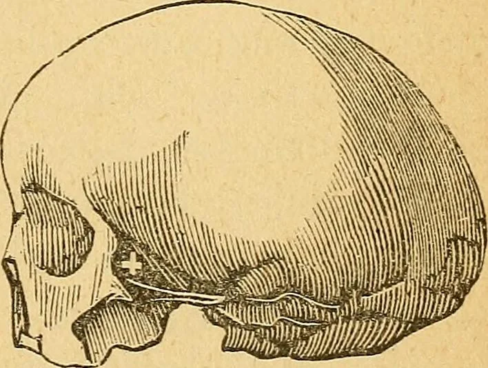 An illustration from How to read character : a new illustrated hand-book of phrenology and physiognomy, for students and examiners : with a descriptive chart, 1890, leaf 78