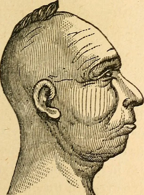 An illustration from How to read character : a new illustrated hand-book of phrenology and physiognomy, for students and examiners; with a descriptive chart, 1891, leaf 36
