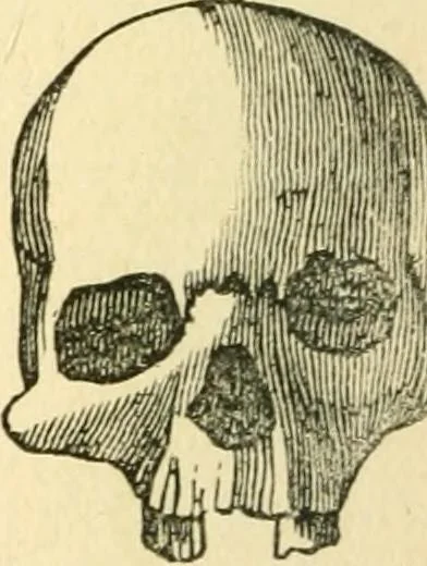 An illustration from How to read character : a new illustrated hand-book of phrenology and physiognomy, for students and examiners; with a descriptive chart, 1891, leaf 59