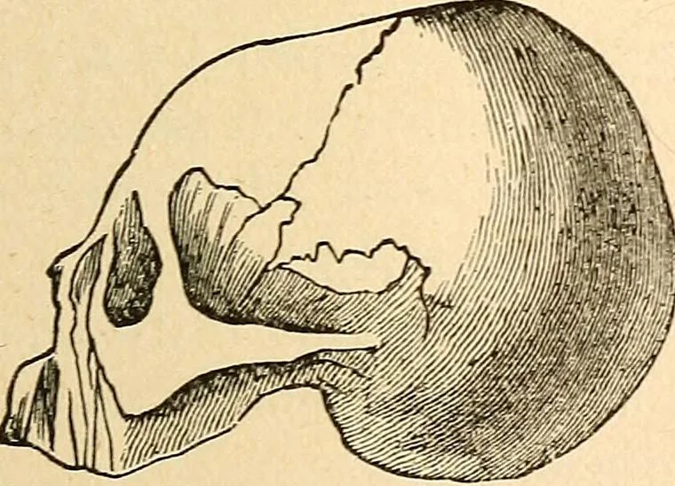 An illustration from How to read character : a new illustrated hand-book of phrenology and physiognomy, for students and examiners; with a descriptive chart, 1891, leaf 78