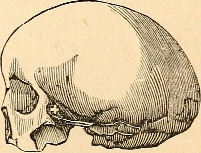 An illustration from How to read character : a new illustrated hand-book of phrenology and physiognomy, for students and examiners; with a descriptive chart, 1891, leaf 78