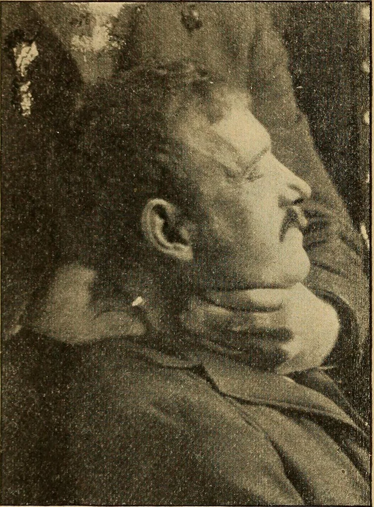 An illustration from How to read the human head and face, 1903, leaf 101