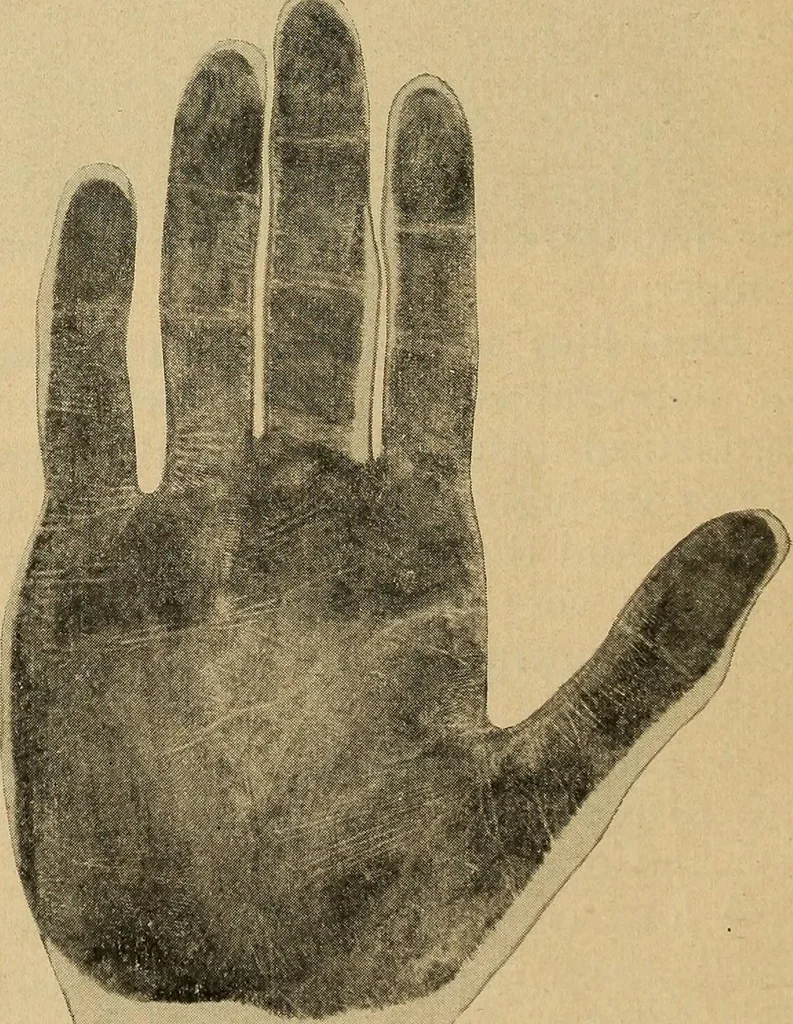 An illustration from How to read the human head and face, 1903, leaf 103