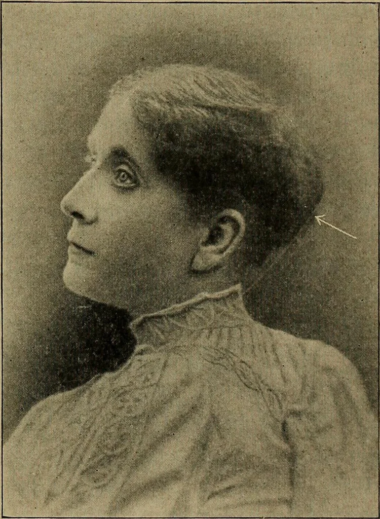 An illustration from How to read the human head and face, 1903, leaf 34