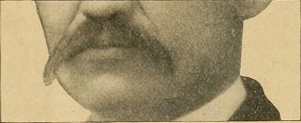 An illustration from How to read the human head and face, 1903, leaf 99