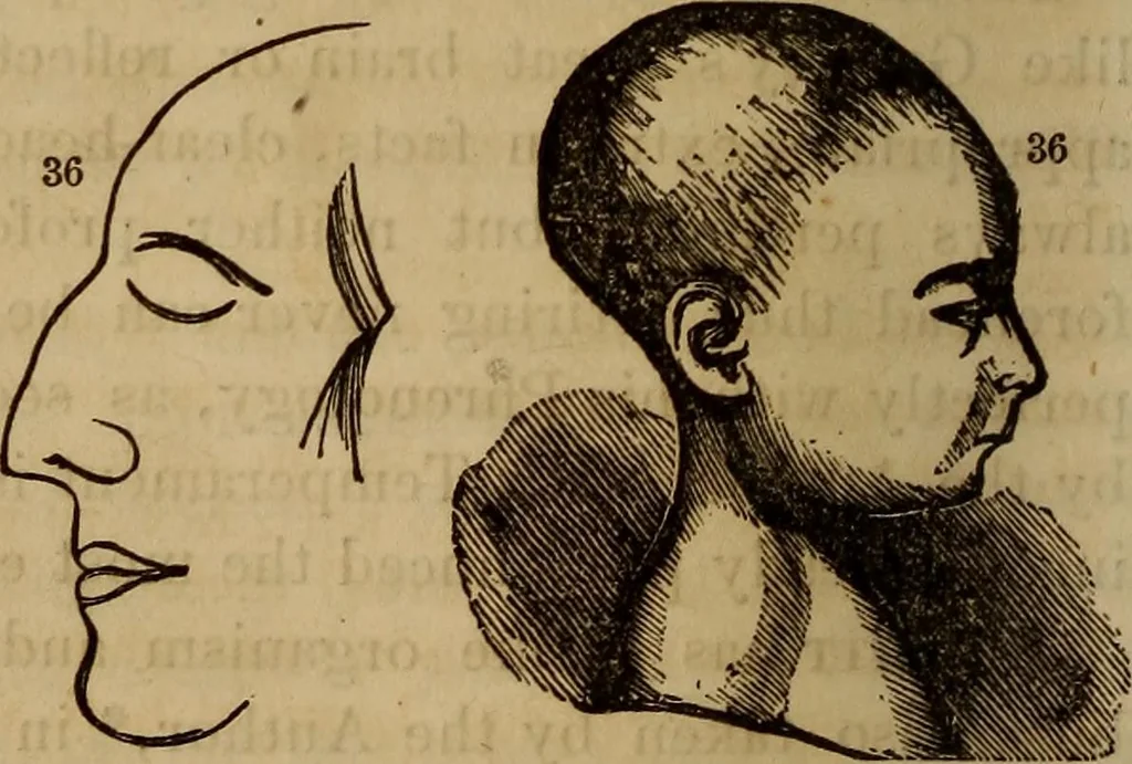 An illustration from Human science, or, Phrenology : its principles, proofs, faculties, organs, temperaments, combinations, conditions, teachings, philosophies, etc., etc. : as applied to health, its values, laws, functions, organs, means, preservation, restoration, etc. : mental philosophy, human and self improvement, civilization, home, country, commerce, rights, duties, ethics, etc. : God, His existence, attributes, laws, worship, natural theology, etc. : immortality, its evidences, conditions, relations to time, rewards, punishments, sin, faith, prayer, etc. : intellect, memory, juvenile and self education, literature, mental discipline, the senses, sciences, arts, avocations, a perfect life, etc., etc., etc., 1873, leaf 1069