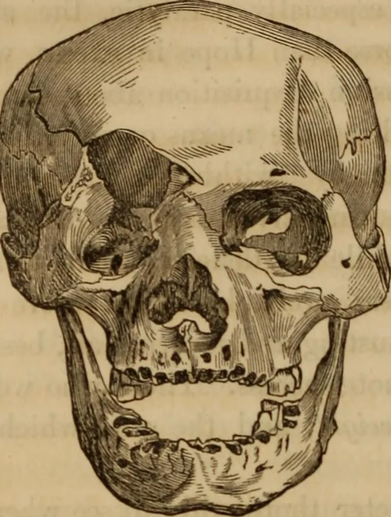 An illustration from Human science, or, Phrenology : its principles, proofs, faculties, organs, temperaments, combinations, conditions, teachings, philosophies, etc., etc. : as applied to health, its values, laws, functions, organs, means, preservation, restoration, etc. : mental philosophy, human and self improvement, civilization, home, country, commerce, rights, duties, ethics, etc. : God, His existence, attributes, laws, worship, natural theology, etc. : immortality, its evidences, conditions, relations to time, rewards, punishments, sin, faith, prayer, etc. : intellect, memory, juvenile and self education, literature, mental discipline, the senses, sciences, arts, avocations, a perfect life, etc., etc., etc., 1873, leaf 1221