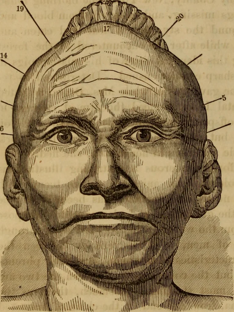 An illustration from Human science, or, Phrenology : its principles, proofs, faculties, organs, temperaments, combinations, conditions, teachings, philosophies, etc., etc. : as applied to health, its values, laws, functions, organs, means, preservation, restoration, etc. : mental philosophy, human and self improvement, civilization, home, country, commerce, rights, duties, ethics, etc. : God, His existence, attributes, laws, worship, natural theology, etc. : immortality, its evidences, conditions, relations to time, rewards, punishments, sin, faith, prayer, etc. : intellect, memory, juvenile and self education, literature, mental discipline, the senses, sciences, arts, avocations, a perfect life, etc., etc., etc., 1873, leaf 205