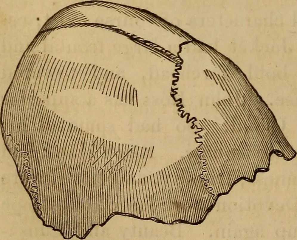 An illustration from Human science, or, Phrenology : its principles, proofs, faculties, organs, temperaments, combinations, conditions, teachings, philosophies, etc., etc. : as applied to health, its values, laws, functions, organs, means, preservation, restoration, etc. : mental philosophy, human and self improvement, civilization, home, country, commerce, rights, duties, ethics, etc. : God, His existence, attributes, laws, worship, natural theology, etc. : immortality, its evidences, conditions, relations to time, rewards, punishments, sin, faith, prayer, etc. : intellect, memory, juvenile and self education, literature, mental discipline, the senses, sciences, arts, avocations, a perfect life, etc., etc., etc., 1873, leaf 207