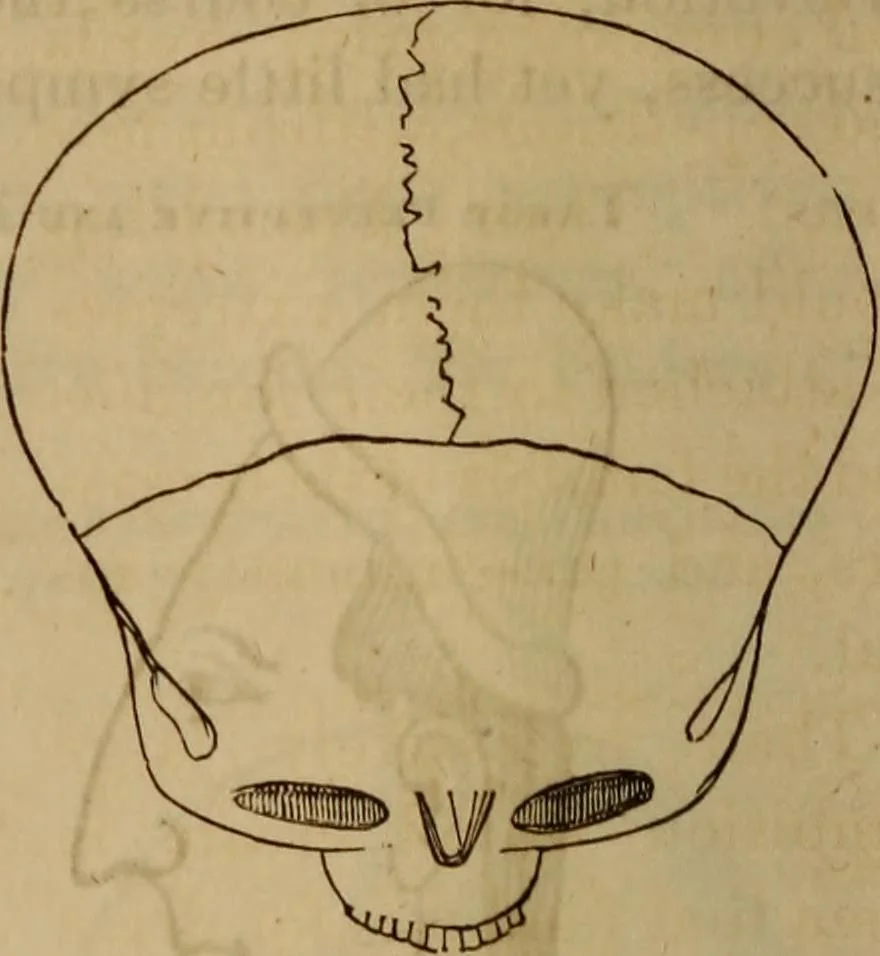 An illustration from Human science, or, Phrenology : its principles, proofs, faculties, organs, temperaments, combinations, conditions, teachings, philosophies, etc., etc. : as applied to health, its values, laws, functions, organs, means, preservation, restoration, etc. : mental philosophy, human and self improvement, civilization, home, country, commerce, rights, duties, ethics, etc. : God, His existence, attributes, laws, worship, natural theology, etc. : immortality, its evidences, conditions, relations to time, rewards, punishments, sin, faith, prayer, etc. : intellect, memory, juvenile and self education, literature, mental discipline, the senses, sciences, arts, avocations, a perfect life, etc., etc., etc., 1873, leaf 209