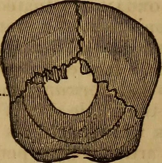 An illustration from Human science, or, Phrenology : its principles, proofs, faculties, organs, temperaments, combinations, conditions, teachings, philosophies, etc., etc. : as applied to health, its values, laws, functions, organs, means, preservation, restoration, etc. : mental philosophy, human and self improvement, civilization, home, country, commerce, rights, duties, ethics, etc. : God, His existence, attributes, laws, worship, natural theology, etc. : immortality, its evidences, conditions, relations to time, rewards, punishments, sin, faith, prayer, etc. : intellect, memory, juvenile and self education, literature, mental discipline, the senses, sciences, arts, avocations, a perfect life, etc., etc., etc., 1873, leaf 674