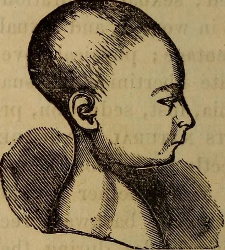 An illustration from Human science, or, Phrenology : its principles, proofs, faculties, organs, temperaments, combinations, conditions, teachings, philosophies, etc., etc. : as applied to health, its values, laws, functions, organs, means, preservation, restoration, etc. : mental philosophy, human and self improvement, civilization, home, country, commerce, rights, duties, ethics, etc. : God, His existence, attributes, laws, worship, natural theology, etc. : immortality, its evidences, conditions, relations to time, rewards, punishments, sin, faith, prayer, etc. : intellect, memory, juvenile and self education, literature, mental discipline, the senses, sciences, arts, avocations, a perfect life, etc., etc., etc., 1873, leaf 705
