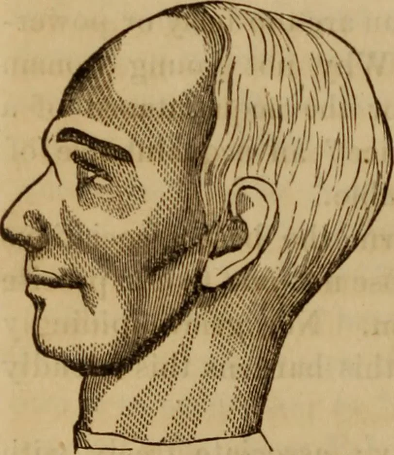 An illustration from Human science, or, Phrenology : its principles, proofs, faculties, organs, temperaments, combinations, conditions, teachings, philosophies, etc., etc. : as applied to health, its values, laws, functions, organs, means, preservation, restoration, etc. : mental philosophy, human and self improvement, civilization, home, country, commerce, rights, duties, ethics, etc. : God, His existence, attributes, laws, worship, natural theology, etc. : immortality, its evidences, conditions, relations to time, rewards, punishments, sin, faith, prayer, etc. : intellect, memory, juvenile and self education, literature, mental discipline, the senses, sciences, arts, avocations, a perfect life, etc., etc., etc., 1873, leaf 733