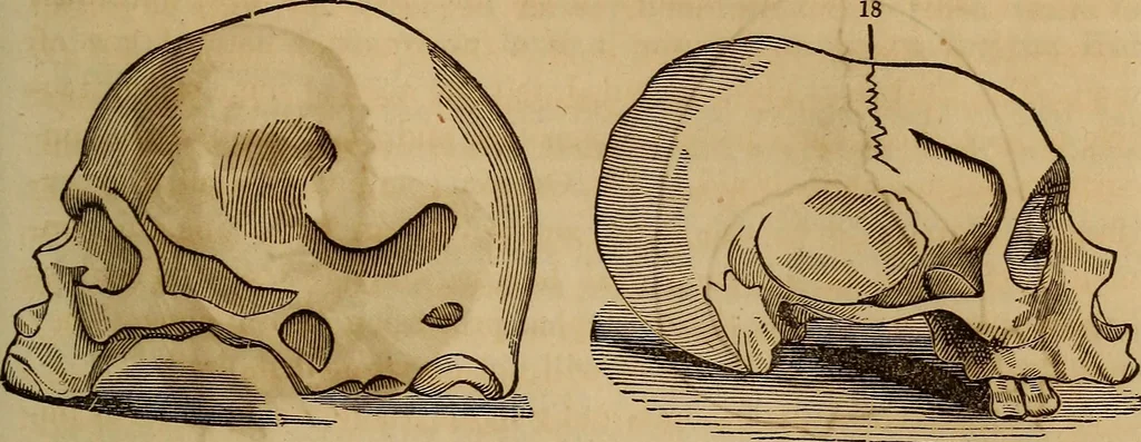 An illustration from Human science, or, Phrenology : its principles, proofs, faculties, organs, temperaments, combinations, conditions, teachings, philosophies, etc., etc. : as applied to health, its values, laws, functions, organs, means, preservation, restoration, etc. : mental philosophy, human and self improvement, civilization, home, country, commerce, rights, duties, ethics, etc. : God, His existence, attributes, laws, worship, natural theology, etc. : immortality, its evidences, conditions, relations to time, rewards, punishments, sin, faith, prayer, etc. : intellect, memory, juvenile and self education, literature, mental discipline, the senses, sciences, arts, avocations, a perfect life, etc., etc., etc., 1873, leaf 806