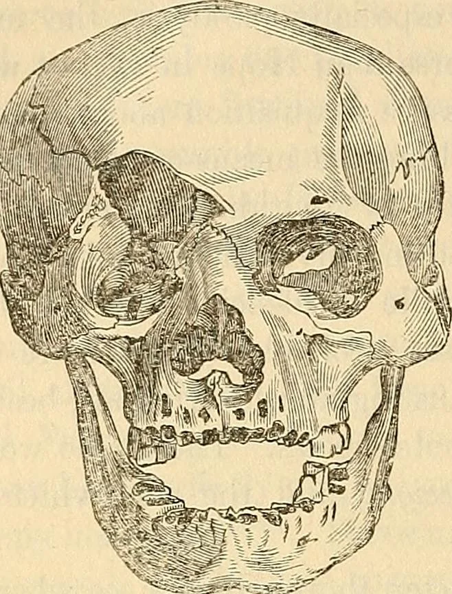 An illustration from Human science or phrenology. Its principles, proofs, faculties, organs, temperaments, combinations, conditions, teachings, philosophies, etc., etc. as applied to health. Its value, laws, functions, organs, means, preservation, restoration, etc. Mental philosophy, human and self improvement, civilization, home country, commerce rights, duties, ethics, etc. God, His existence, attributes, laws, worship, natural theology, etc. Immortality, its evidences, conditions, relations to time, rewards, punishments, sin, faith, prayer, etc. Intellect, memory, juvenile and self education, literature, mental discipline, the senses, sciences, arts, avocations, a perfect life, etc., etc, 1880, leaf 1217