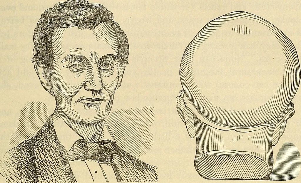 An illustration from Human science or phrenology. Its principles, proofs, faculties, organs, temperaments, combinations, conditions, teachings, philosophies, etc., etc. as applied to health. Its value, laws, functions, organs, means, preservation, restoration, etc. Mental philosophy, human and self improvement, civilization, home country, commerce rights, duties, ethics, etc. God, His existence, attributes, laws, worship, natural theology, etc. Immortality, its evidences, conditions, relations to time, rewards, punishments, sin, faith, prayer, etc. Intellect, memory, juvenile and self education, literature, mental discipline, the senses, sciences, arts, avocations, a perfect life, etc., etc, 1880, leaf 670