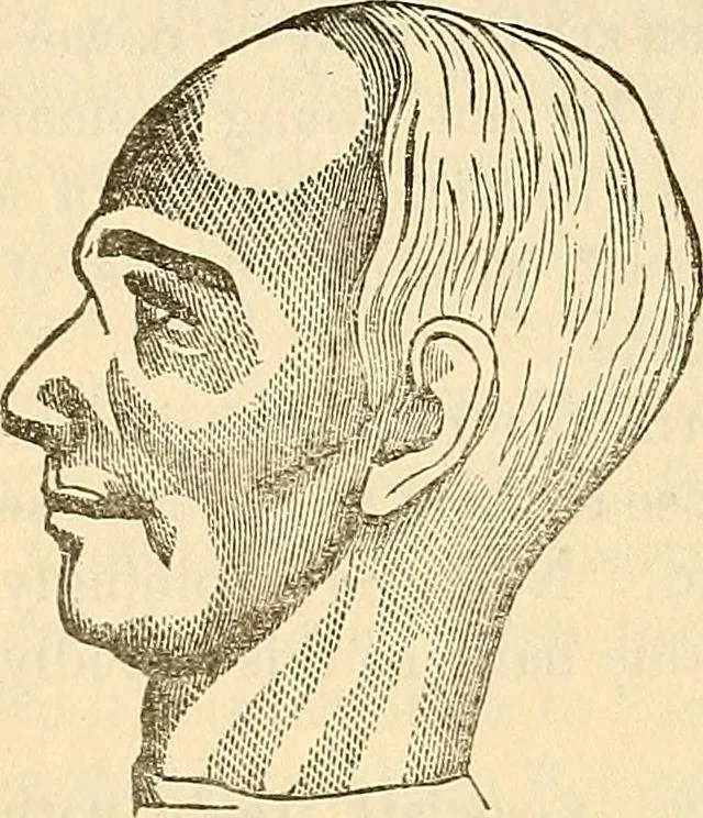 An illustration from Human science or phrenology. Its principles, proofs, faculties, organs, temperaments, combinations, conditions, teachings, philosophies, etc., etc. as applied to health. Its value, laws, functions, organs, means, preservation, restoration, etc. Mental philosophy, human and self improvement, civilization, home country, commerce rights, duties, ethics, etc. God, His existence, attributes, laws, worship, natural theology, etc. Immortality, its evidences, conditions, relations to time, rewards, punishments, sin, faith, prayer, etc. Intellect, memory, juvenile and self education, literature, mental discipline, the senses, sciences, arts, avocations, a perfect life, etc., etc, 1880, leaf 729