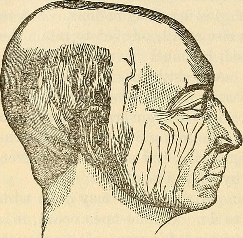 An illustration from Human science or phrenology. Its principles, proofs, faculties, organs, temperaments, combinations, conditions, teachings, philosophies, etc., etc. as applied to health. Its value, laws, functions, organs, means, preservation, restoration, etc. Mental philosophy, human and self improvement, civilization, home country, commerce rights, duties, ethics, etc. God, His existence, attributes, laws, worship, natural theology, etc. Immortality, its evidences, conditions, relations to time, rewards, punishments, sin, faith, prayer, etc. Intellect, memory, juvenile and self education, literature, mental discipline, the senses, sciences, arts, avocations, a perfect life, etc., etc, 1880, leaf 745