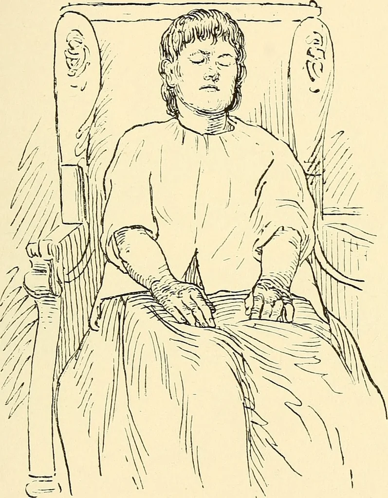 An illustration from Hypnotism, mesmerism and the new witchcraft, 1896, leaf 56