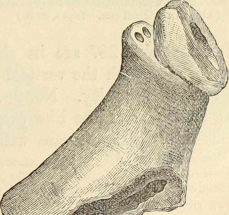 An illustration from Ilios; the city and country of the Trojans. The results of researches and discoveries on the site of Troy and throughout the Troad in the years 1871-72-73-78-79, including an autobiography of the author, 1880, leaf 392