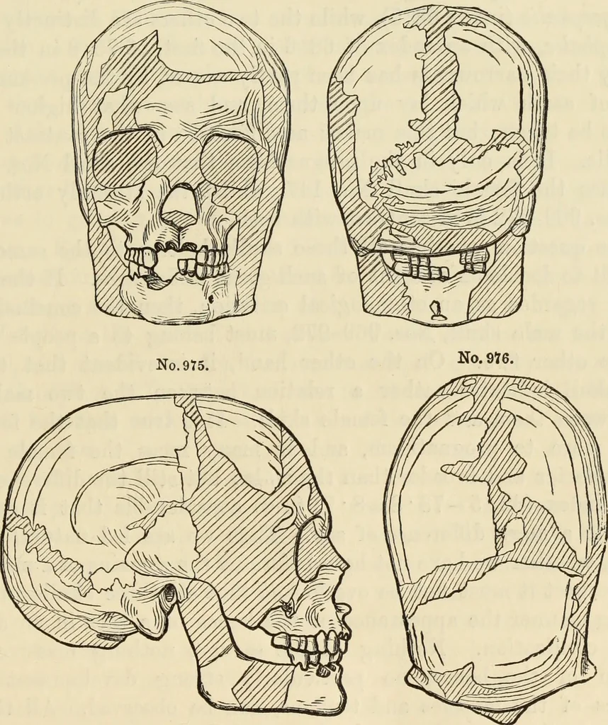An illustration from Ilios; the city and country of the Trojans. The results of researches and discoveries on the site of Troy and throughout the Troad in the years 1871-72-73-78-79, including an autobiography of the author, 1880, leaf 538