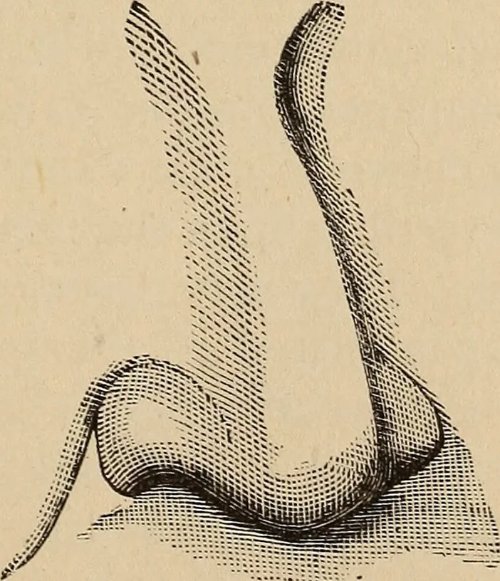 An illustration from Illustrated physiognomy, 1879, leaf 44