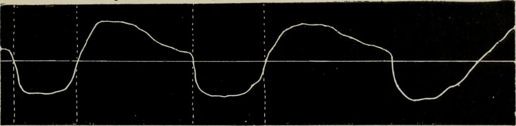 An illustration from The influence of dress in producing the physical decadence of American women : annual address upon obstetrics and gynecology, 1891, leaf 38