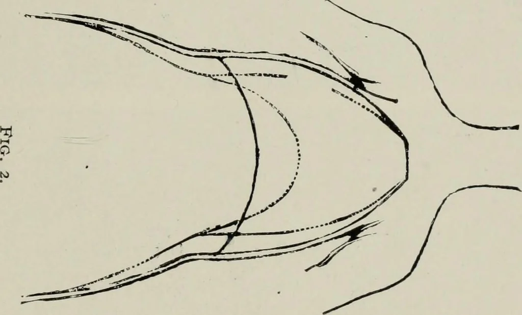An illustration from The influence of dress in producing the physical decadence of American women : annual address upon obstetrics and gynecology, 1891, leaf 42