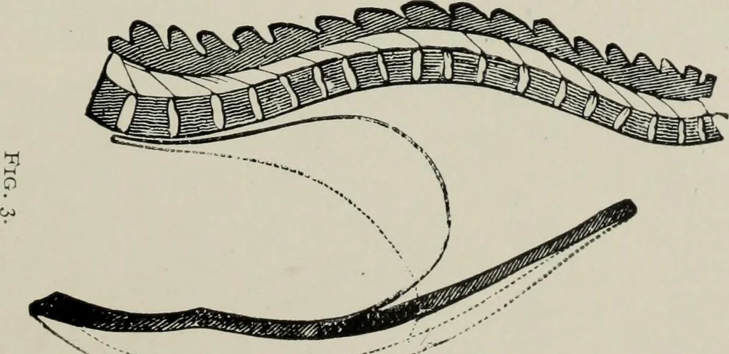 An illustration from The influence of dress in producing the physical decadence of American women : annual address upon obstetrics and gynecology, 1891, leaf 42