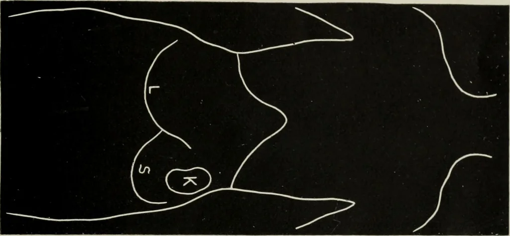 An illustration from The influence of dress in producing the physical decadence of American women : annual address upon obstetrics and gynecology, 1891, leaf 52