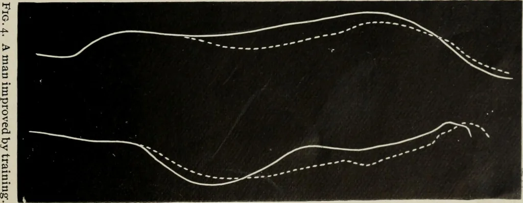 An illustration from The influence of dress in producing the physical decadence of American women : annual address upon obstetrics and gynecology, 1891, leaf 54