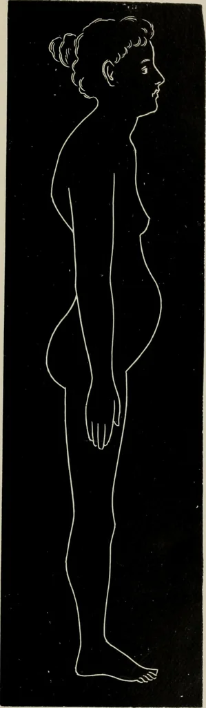 An illustration from The influence of dress in producing the physical decadence of American women : annual address upon obstetrics and gynecology, 1891, leaf 56